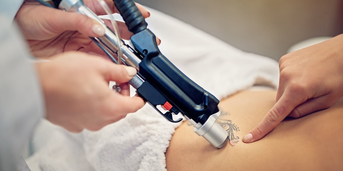 young woman undergoing laser tattoo removal procedure